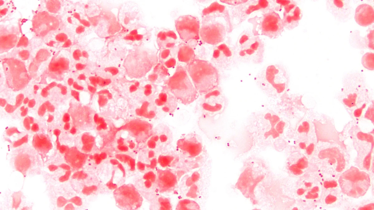 Campo microscópico con numerosas células rosadas y pequeños puntos morados sobre fondo claro.